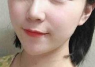 童颜针注射私密有效果吗,揭秘其神奇效果与真实反馈